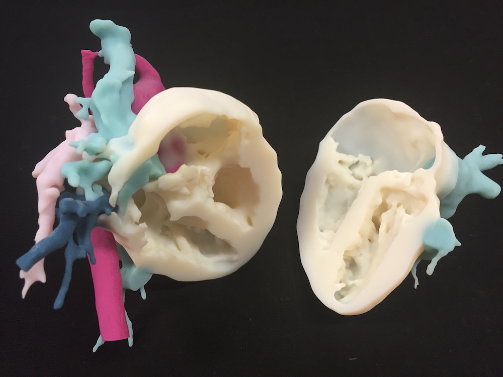 3D medical printing finds its footing in Dubai’s future